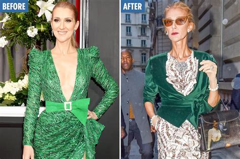 celine dion weight loss reason.